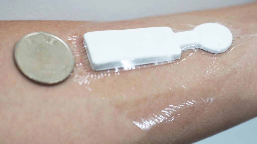 sticker on arm